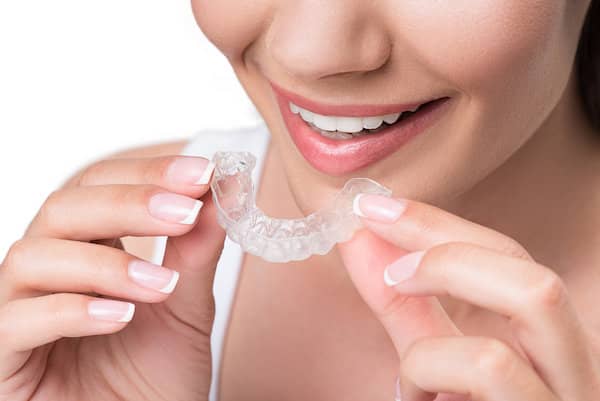 Invisible Braces Calgary, Affordable Braces